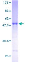 Human RABL3 Protein (Recombinant GST)
