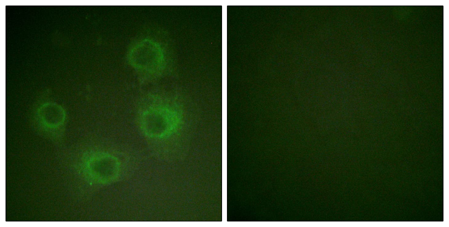 GRIN2A+GRIN2B Antibody (phospho-Tyr1246/Tyr1252)