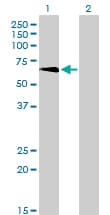 TBX5 Antibody (clone 1G10)