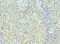 GZMA / Granzyme A Antibody (aa29-262)
