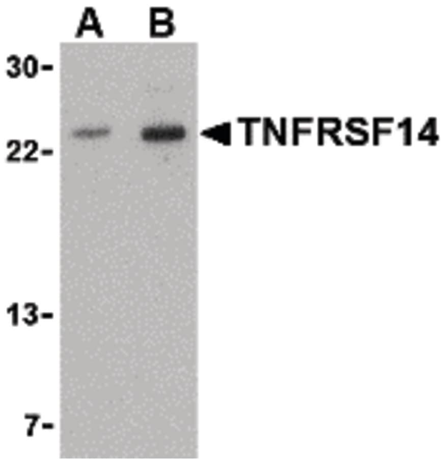 IHC-plus™ Polyclonal Rabbit anti-Human TNFRSF14 / CD270 / HVEM Antibody (IHC, IF, WB)