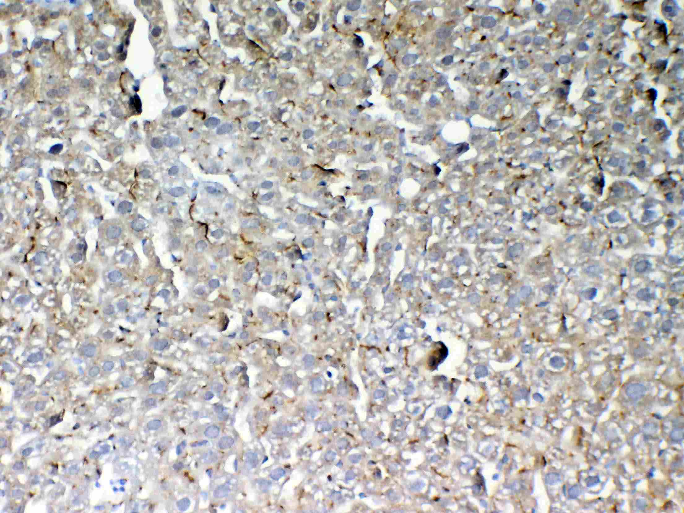GALNS / Chondroitinase Antibody
