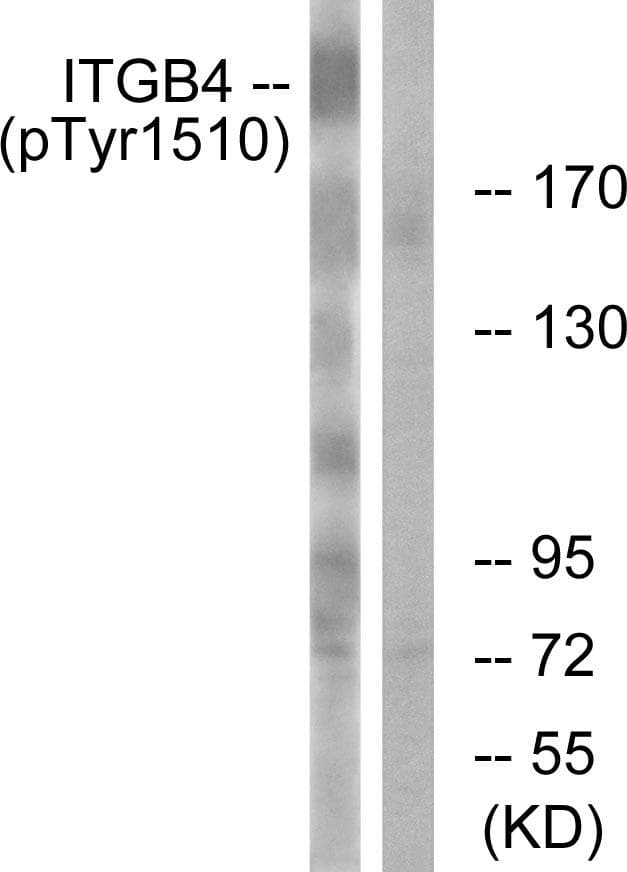 ITGB4 / Integrin Beta 4 Antibody (phospho-Tyr1510)