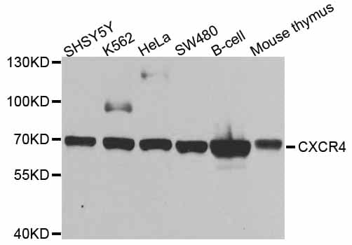 IHC-plus™ Monoclonal Rabbit anti-Human CXCR4 Antibody (IHC, WB)