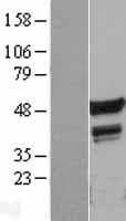 FLI1 Protein (Over-Expression Lysate Myc-DDK (Flag))