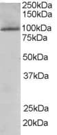IHC-plus™ TAOK3 / JIK Antibody (aa396-411)