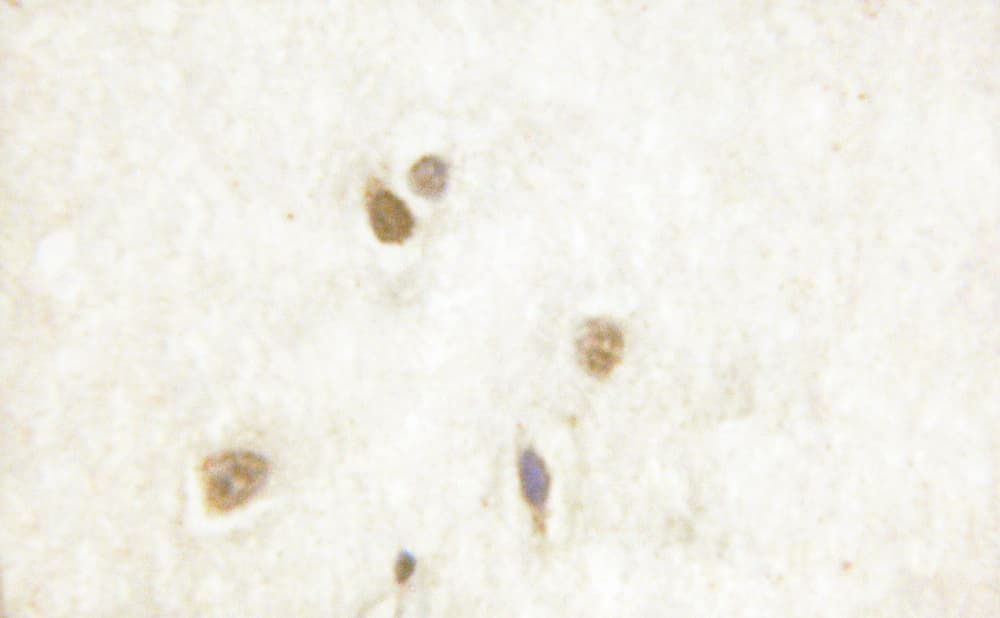 CAMK4 / CaMK IV Antibody (phospho-Thr196,pThr200)