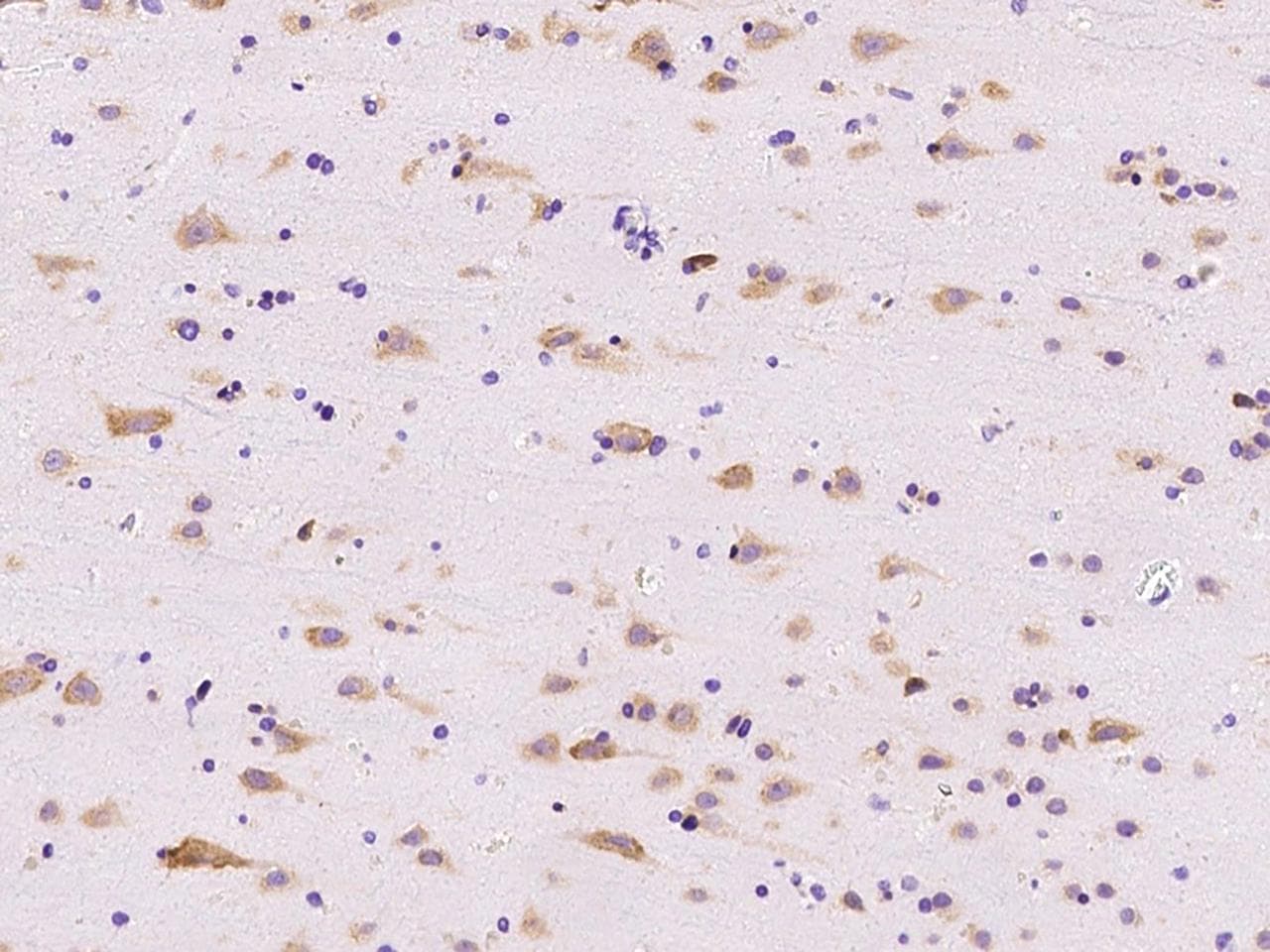 RPL14 / Ribosomal Protein L14 Antibody