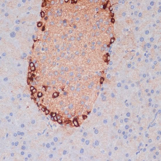Polyclonal Rabbit anti-Human APG5 / ATG5 Antibody (IHC)