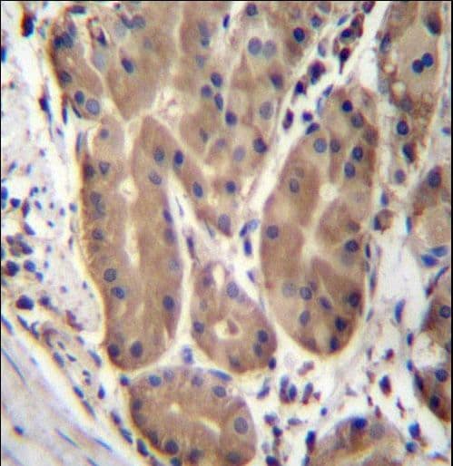 Polyclonal Rabbit anti-Human ABHD2 Antibody (aa263-292, IHC, WB)