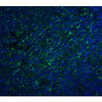 CCR5 Antibody