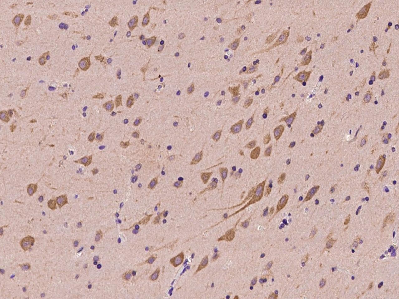 NARS Antibody