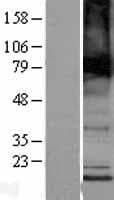 TMEM184B Protein (Over-Expression Lysate Myc-DDK (Flag))