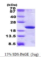Human RPL12 / Ribosomal Protein L12 (Recombinant His)