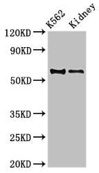 RALDH2 / ALDH1A2 Antibody