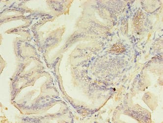 Polyclonal Rabbit anti-Human AZGP1 / ZAG Antibody (WB)