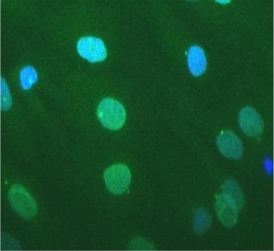 Monoclonal Mouse anti-Human SYNE1 / Nesprin 1 Antibody (clone MANNES1A(7A12), IF, WB)
