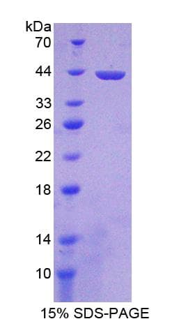 Mouse MSTO1 / MST Protein (Recombinant His-T7)