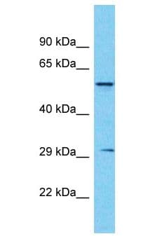 ASMT / HIOMT Antibody (aa2-51)