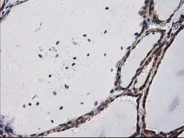 PRKCE / PKC-Epsilon Antibody (clone OTI1B7)