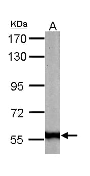 Polyclonal Rabbit anti-Human FTCD / 58K Golgi Protein Antibody (aa1-251, IHC, WB)
