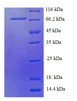 Human HARS2 Protein (Recombinant His-SUMO)