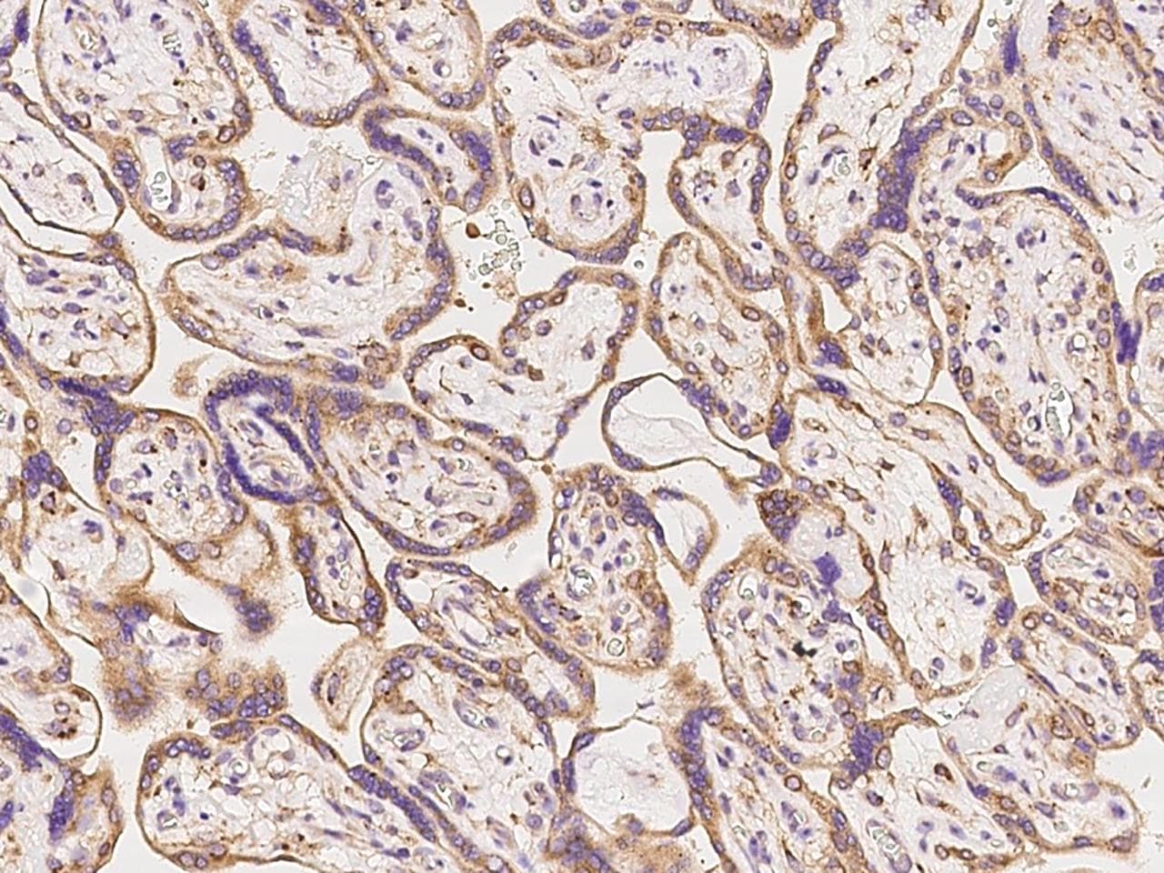 Polyclonal Rabbit anti-Human PPP2R2A Antibody (IHC)