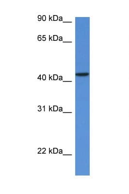 MVD Antibody (aa74-123)