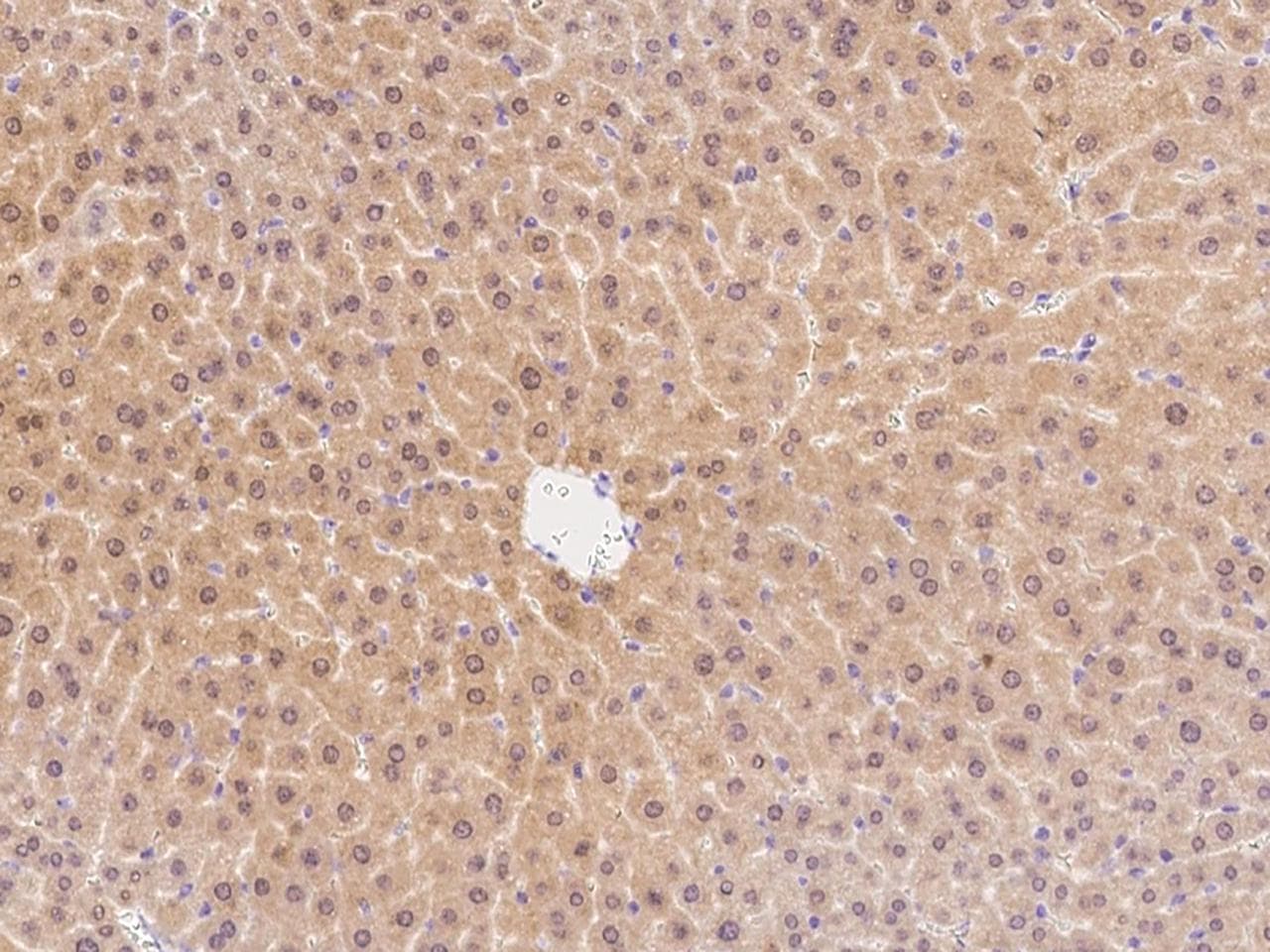 CARMA1 / CARD11 Antibody
