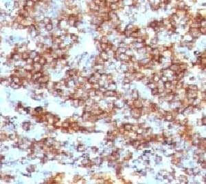 CD45RB Antibody (clone CDLA45RB-1)