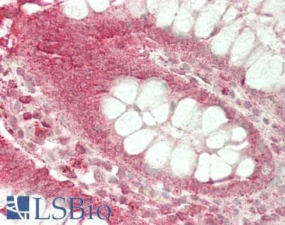 IHC-plus™ HAX-1 Antibody (clone 9F3D11)
