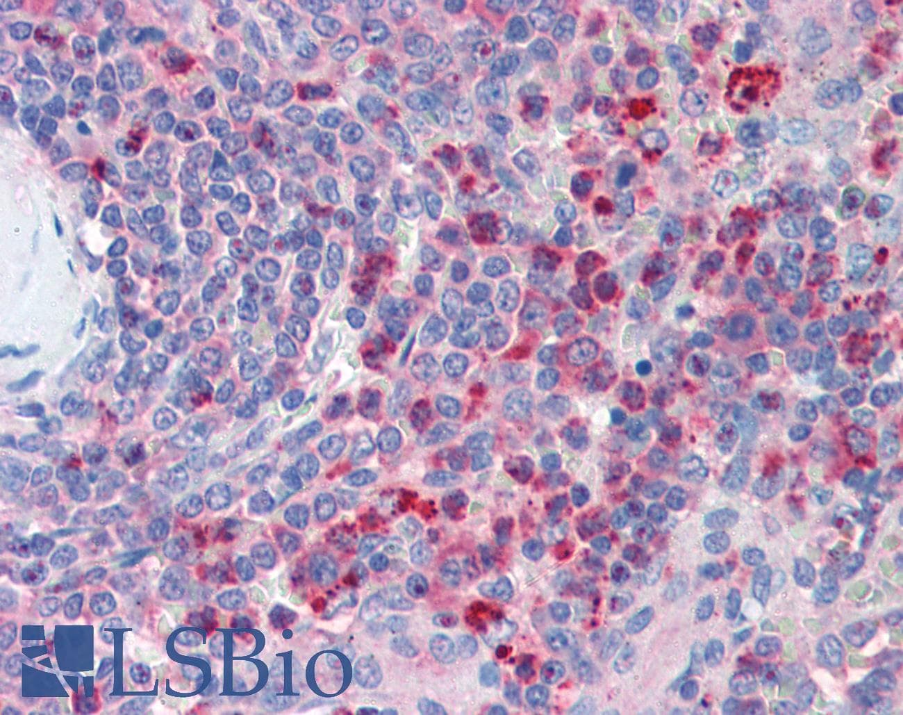 IHC-plus™ CXCR4 Antibody (aa14-40)