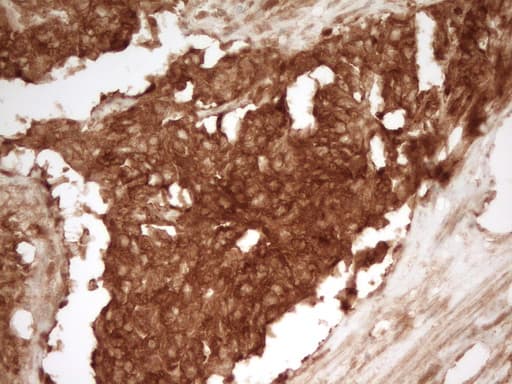 PRMT5 Antibody (aa238-499, clone OTI2C12)