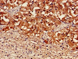 TH / Tyrosine Hydroxylase Antibody (aa2-197)