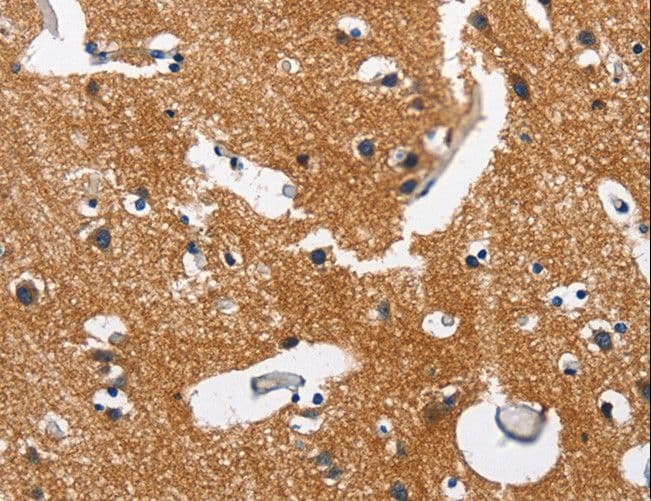 CAMK1D Antibody