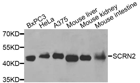 SCRN2 / Ses2 Antibody