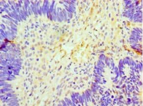 GCKR Antibody (aa1-625, HRP)