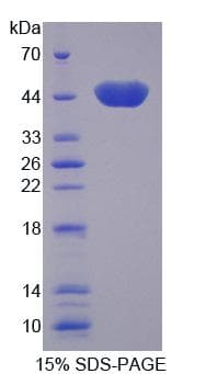 Human CKMT2 Protein (Recombinant His-T7)