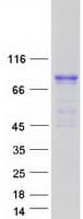 Human CACNB1 Protein (Recombinant Myc-DDK (Flag))