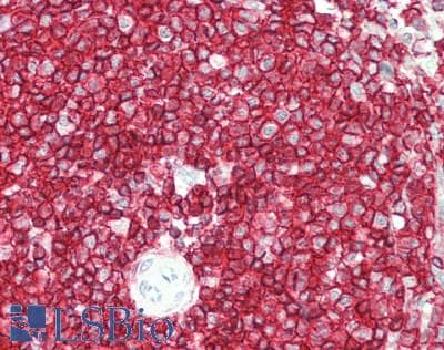 PathPlus™ Polyclonal Goat anti-Human CD45 / LCA Antibody (C-Terminus, IHC, WB)