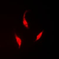 HIWI2 / PIWIL4 Antibody