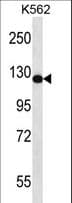 NGAP / RASAL2 Antibody (aa675-703)