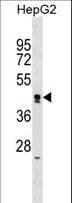 ZNF556 Antibody (aa102-128)