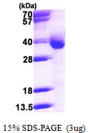Human CYB5R3 / B5R Protein (Recombinant His)