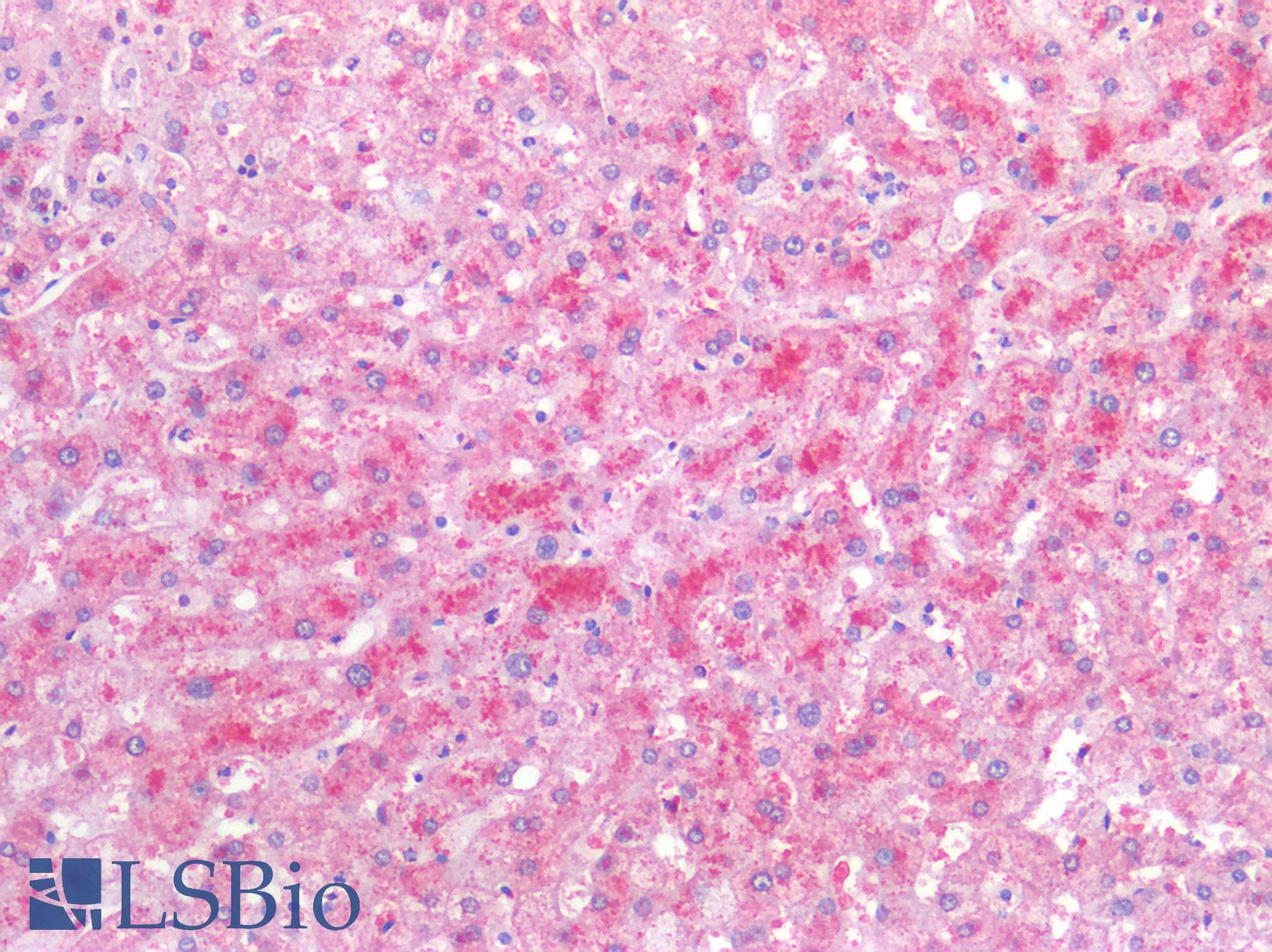 IHC-plus™ Polyclonal Rabbit anti-Human VEGFA / VEGF Antibody (IHC)