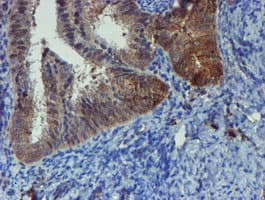 PPAT Antibody (aa42-278, clone OTI1B8)