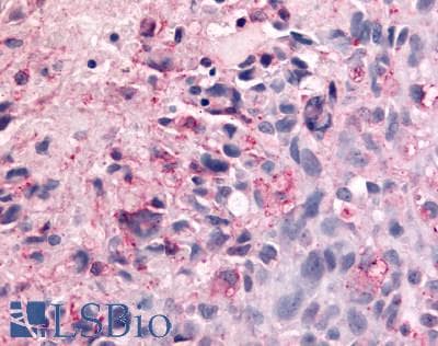 PathPlus™ ADGRB2 / BAI2 Antibody (N-Terminus)