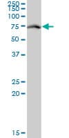 IHC-plus™ Monoclonal Mouse anti-Human RACGAP1 / MGCRACGAP Antibody (clone 1G6, IHC, WB)
