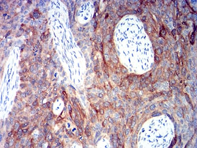 ALDH1A1 / ALDH1 Antibody (clone 2G1G4)