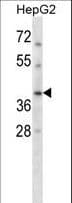Polyclonal Rabbit anti-Human RAD51C Antibody (aa169-198, WB)